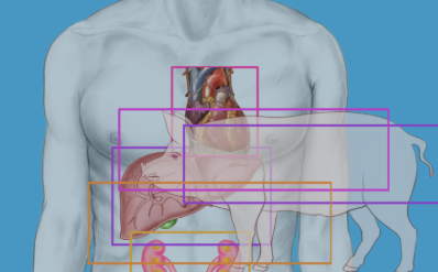 China Sukses Tanamkan Hati Babi ke Tubuh Manusia untuk Pertama Kali